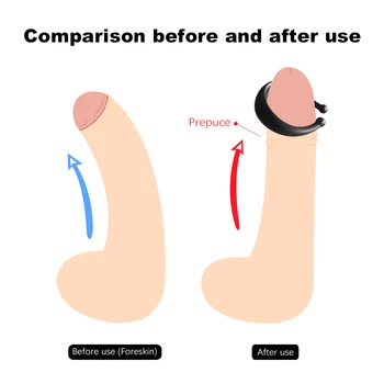 EXVOID 2 Veľkosť Penisu Krúžok Predkožky Oprava Oneskorenie Ejakulácie Penis Rukáv Mieška Viazať Intímne Tovaru Krúžky na Penis